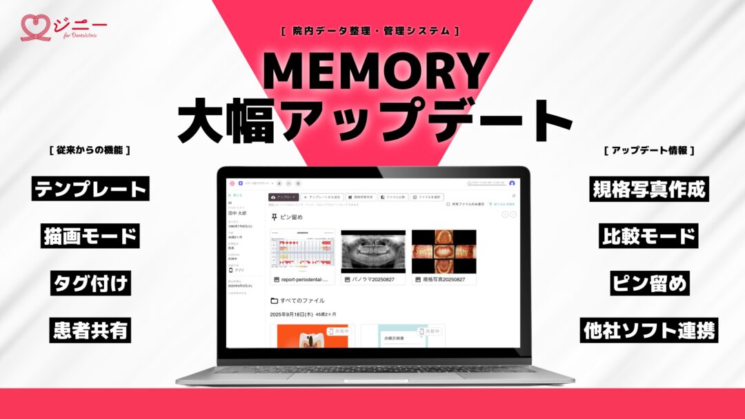 Memory大幅アップデート